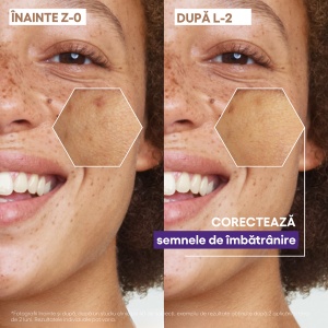 Ser reparator pentru luminozitate cu vitamina C Epitheliale Ultra Repair, 30 ml, A-Derma - Img 4