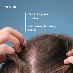 Ducray Anaphase Șampon Împotriva Căderii Reactive a Părului, 100 ml - Img 4