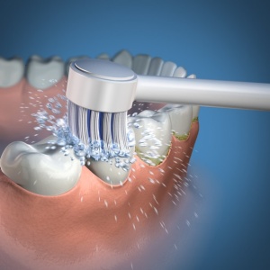 Waterpik TB-100E – Set 2 Capete Tip Periuta pentru Dus Bucal - Img 2