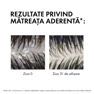 Vichy Dercos Sampon Anti-matreata pentru par normal pana la gras, rezerva eco 390 ml - Img 9