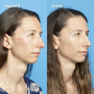 Fond de Ten Toleriane Fluid Corector SPF 25, 16h, Nuata 10, 30ml, La Roche-Posay - Img 4