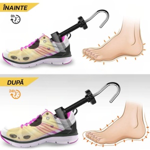 Set 2 Sanuri/Calapoade Reglabilile, Flippy, pentru Alungit si Largit Pantofi, Geanta si Incaltator Incluse, Universale, Unisex, din ABS Premium, Arc, Marime 40 - 47, Galben/Negru - Img 7