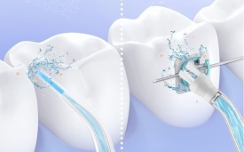 Портативен зъбен душ с мощна водна струя и 4 приставки - Img 2