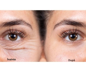 Cremă anti-rid cu Venin de Albină - Img 3