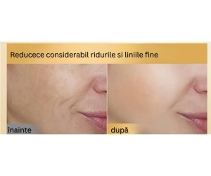 SADOER Cremă de față anti-rid cu Venin de Albină, 50g - Img 2