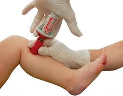 Bone Injection Gun Penn Care