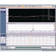 Dostupno Shiller 3 Kanala Medilog AR -12Swiss Holter EKG Shiller