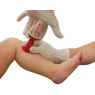 Bone Injection Gun Penn Care
