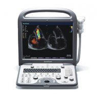 SonoScape S8 Portabilni Ultrazvucni Aparat
