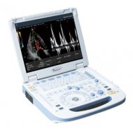 Fokuda portabilni ultrazvuk-超音波画像診断装置 UF-760AG＋ PaoLus＋