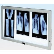 Dostupno LED Negatoskop 1,2, i 3. Snimka LED Verzija Ravnomerno Osvetljenje