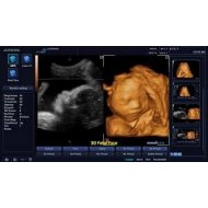 Preporuka 2D/3D/4D /Alpinion E Cube -9 Diamond Ultrazvucni Aparat