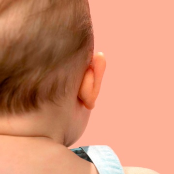 Otostick Bebe Corector Estetic Pentru Urechi, 8 Bucati - Img 4