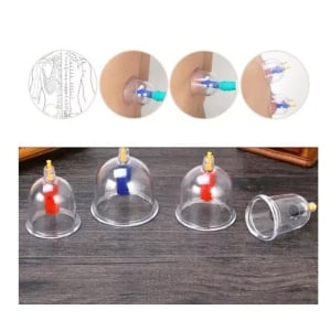 Set 24 ventuze de masaj terapeutic cu vacuum, magnetoterapie si acupresura EXTRAMEDICUS® - Img 3