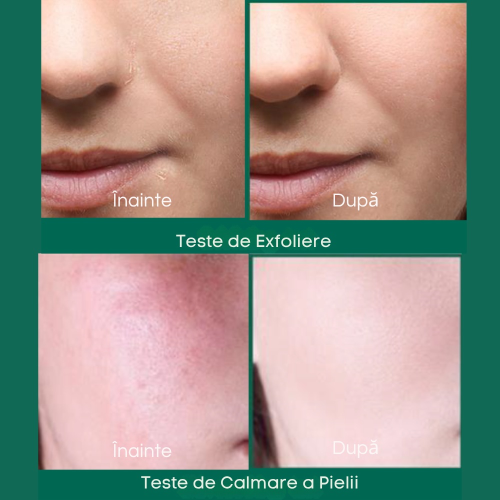 SOMEBYMI, AHA, BHA, PHA 30 Days Miracle Serum, ser pentru față, 50 ml - 1 | YEO