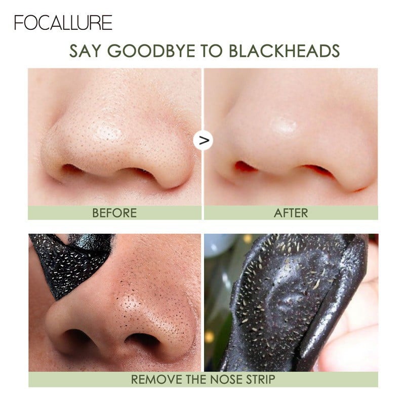 Plasturi Pentru Puncte Negre Focallure Blackheads, 1 Bucata - 3 | YEO