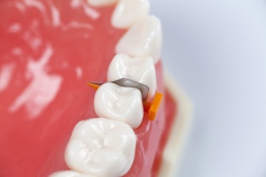 Pene plastic Fenderwedge Directa Dental - Img 3