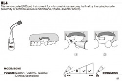 Ansa Chirurgicala UL4 Mectron Woodpecker