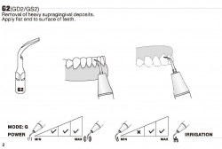 Ansa Detartraj GD2 DTE/SATELEC Woodpecker