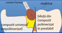 Spatula modelatoare compozit 1965 TOR VM