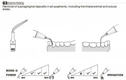 Ansa Detartraj G3 EMS Woodpecker