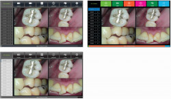 Camera intraorala cu fir Dr’s Cam V