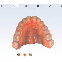 Scanner intraoral Emerald S Planmeca