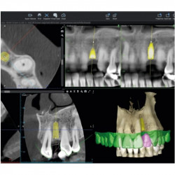 Scanner intraoral Emerald S Planmeca