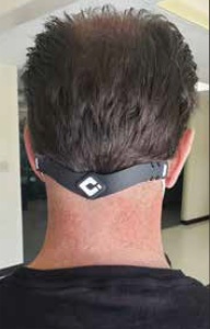 ODI Band for Ear-Saver-Strap 5 Stk., black/pink - Img 3