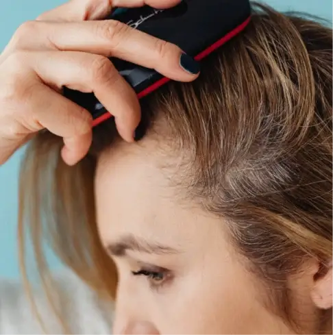 alopecia-la-femei