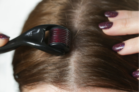 femeie-care-foloseste-derma-roller