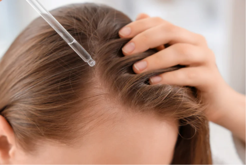 femeie-care-aplica-pipeta-pe-scalp