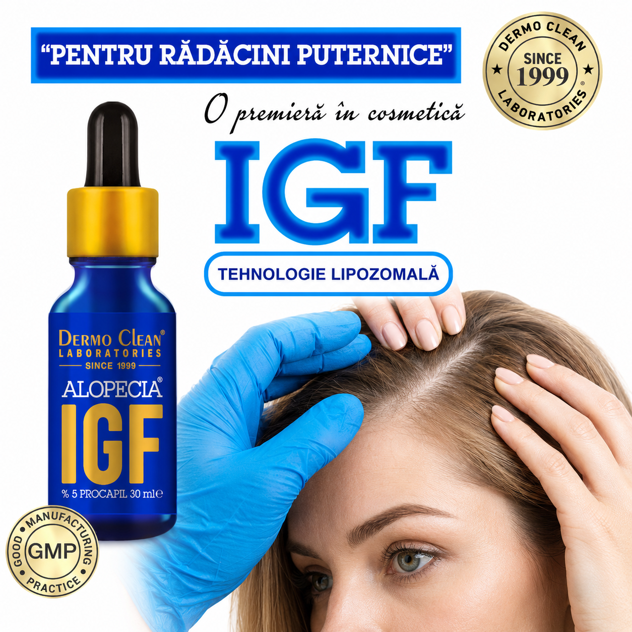 ser-igf-pentru-radacini-puternice
