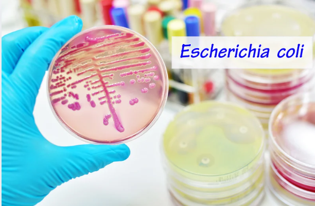 bacteria-e.coli-la-microscop