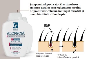 Sampon Anticadere Par cu Procapil, gama Alopecia, 3+1 Gratis - Img 2