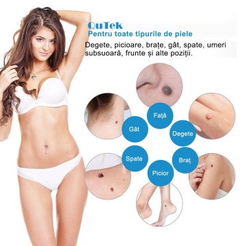 Kit Profesional QuTek 2-în-1 pentru Îndepărtarea Papiloamelor (2-8mm), Metoda Ligaturării, 40 Benzi, 36 Plasturi Repratori, Alb/Albastru - Img 2