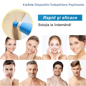 Kit Indepartare Papiloame QuTek- Dispozitiv Ligaturare 2-8mm, Usor de Folosit, Rezultate Rapide, 40 Benzi Cauciuc, 2 Capete Interschimbabile, 10 Servetele Alcool, 36 plasturi transparenti, Alb/Albastru - Img 4