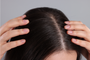 Scalp sensibil: cauze, simptome și metode eficiente de îngrijire