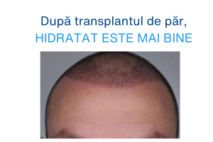 Transplantul de păr și susținerea creșterii părului