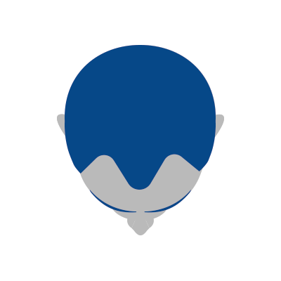 progresie alopecie androgenetica
