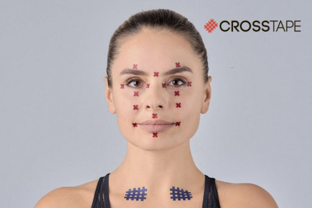Set Plasturi Acupunctură BB ACU TAPE™ (640 buc.) – Benză Acu Corporală - Img 5