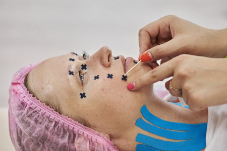 Set Plasturi Acupunctură BB ACU TAPE™ (640 buc.) – Benză Acu Corporală - Img 4