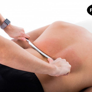 Ghidon mare Instrument FASCIQ® IASTM - Img 4
