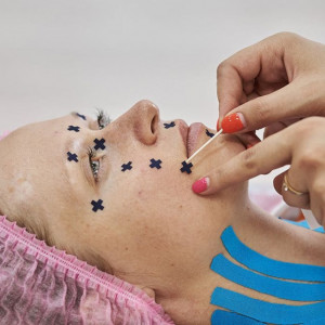 Set Plasturi Acupunctură BB ACU TAPE™ (640 buc.) – Benză Acu Corporală - Img 4