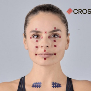 Set Plasturi Acupunctură BB ACU TAPE™ (640 buc.) – Benză Acu Corporală - Img 5