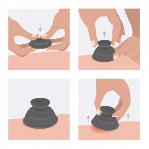 Set Ventuze Trigger Point FASCIQ Cupping Set – Ventuze Silicon - Img 6