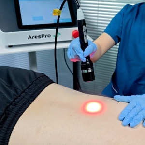 Laser de înaltă intensitate AresPro HP Laser - Img 4