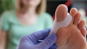 hallux valgus ingrijire medicala