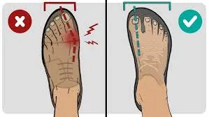 pantofi hallux valgus