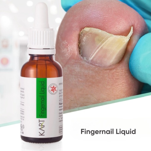 Fingernail Liquid KART - 30ml (7009)